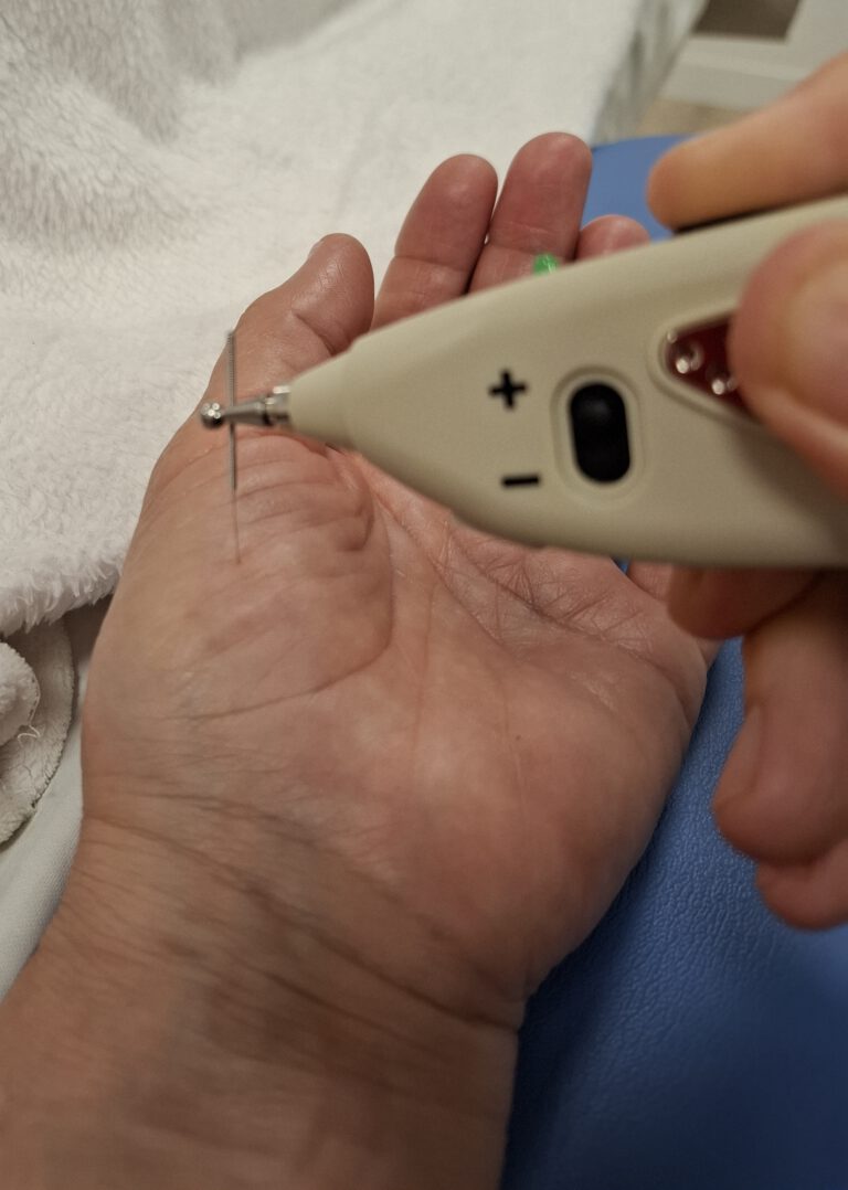 NEUROMODULACIO MA PER BLOG scaled